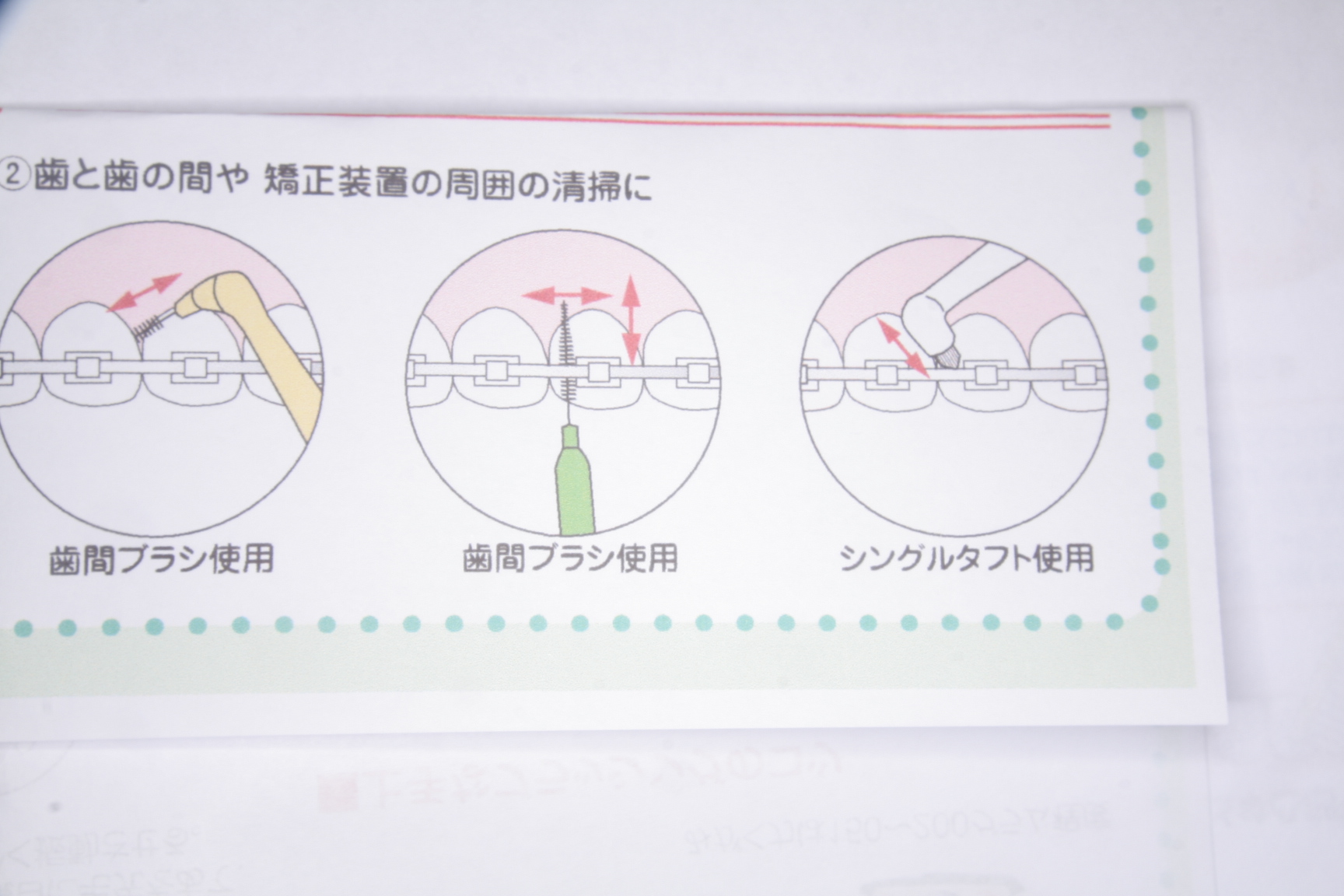 矯正治療中のブラッシングのポイント 四日市市,桑名市,弥富市、東近江市,鈴鹿市、亀山市、東員町, いなべ市,菰野町